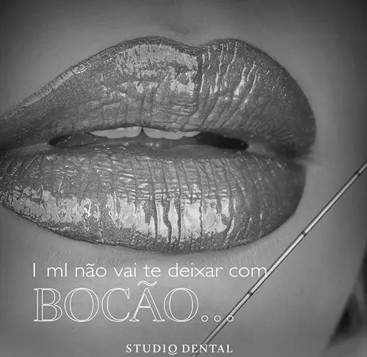 Sorriso harmonizado de paciente da Studio Dental, em Goiânia